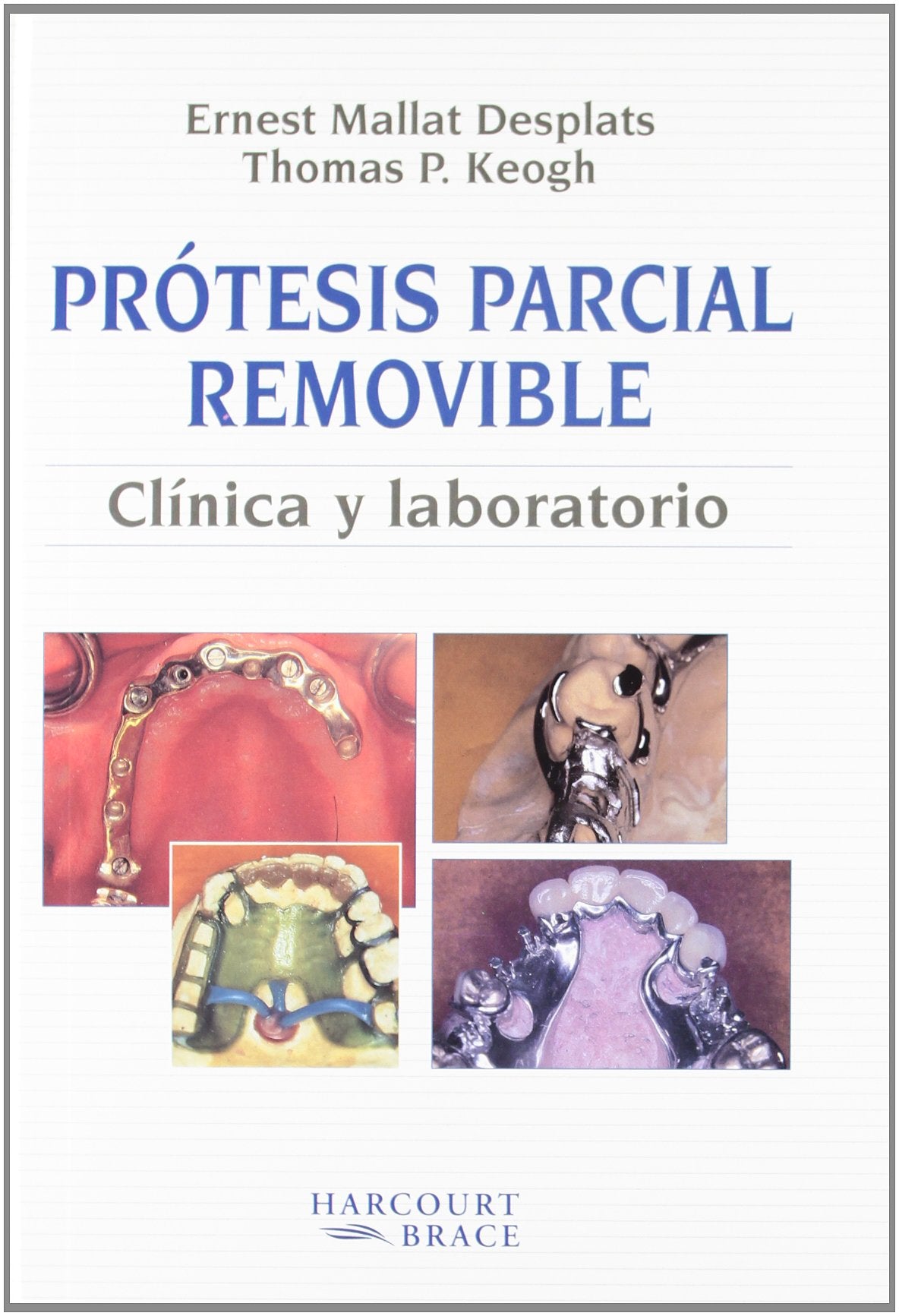 Prótesis parcial removible. Clínica y laboratorio: Clinica Y Laboratorio