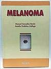 Melanoma