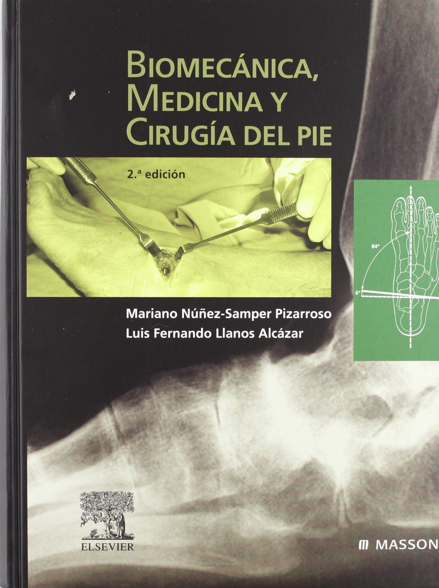 Biomecánica, medicina y cirugía del pie
