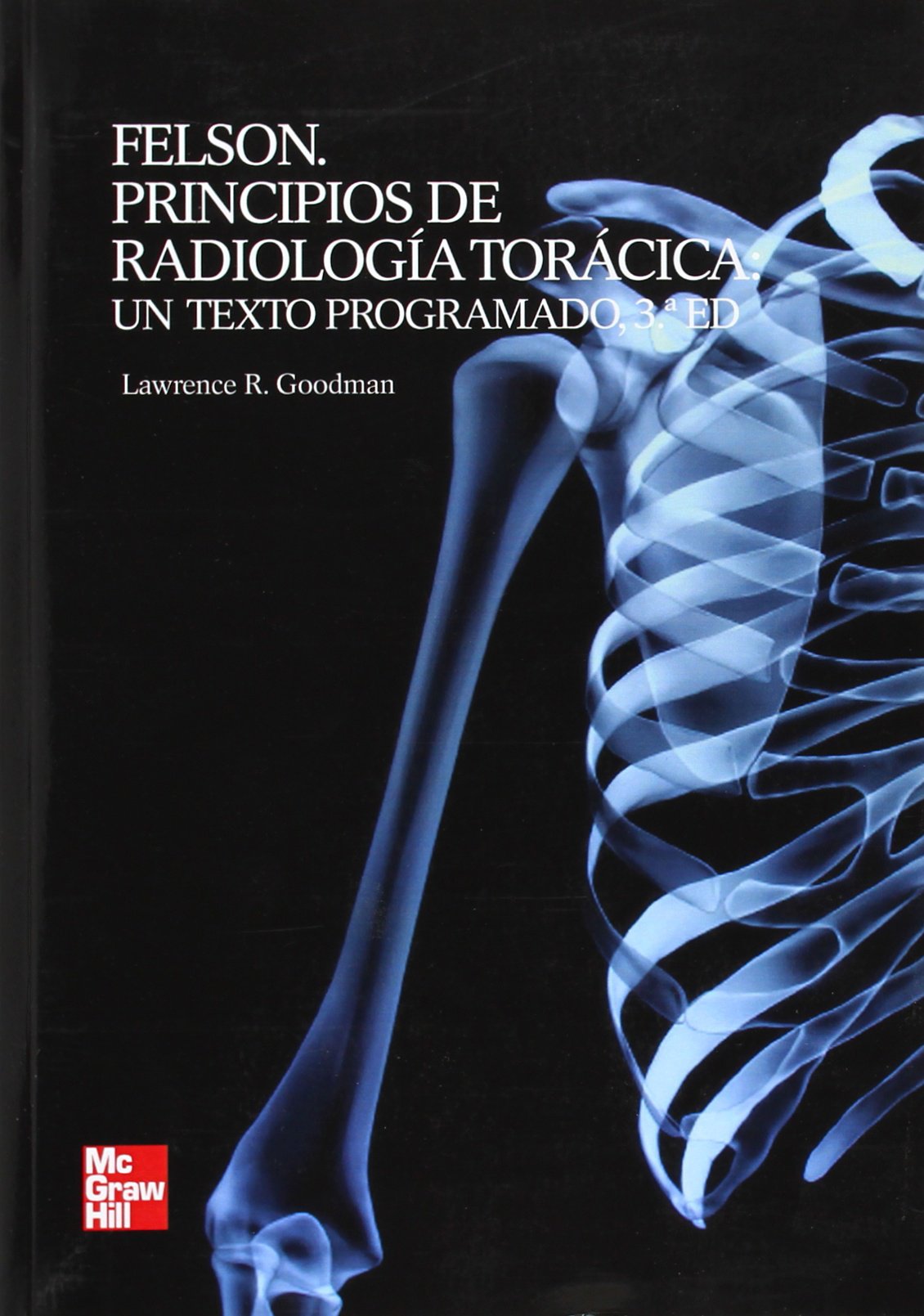 FELSON PRINCIPIOS DE RADIOLOGIA: UN TEXTO PROGRAMADO