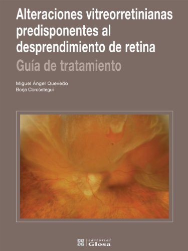 Altearciones Vitreorretinianas Predisponentes Al Desprendimiento De Retina. Guía De Tratamiento