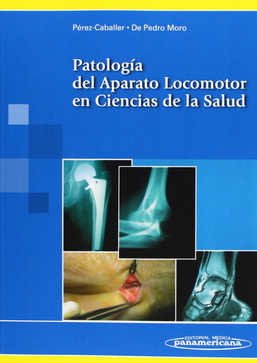 PEREZ-CABALLER:Pat. Aparato Locomotor