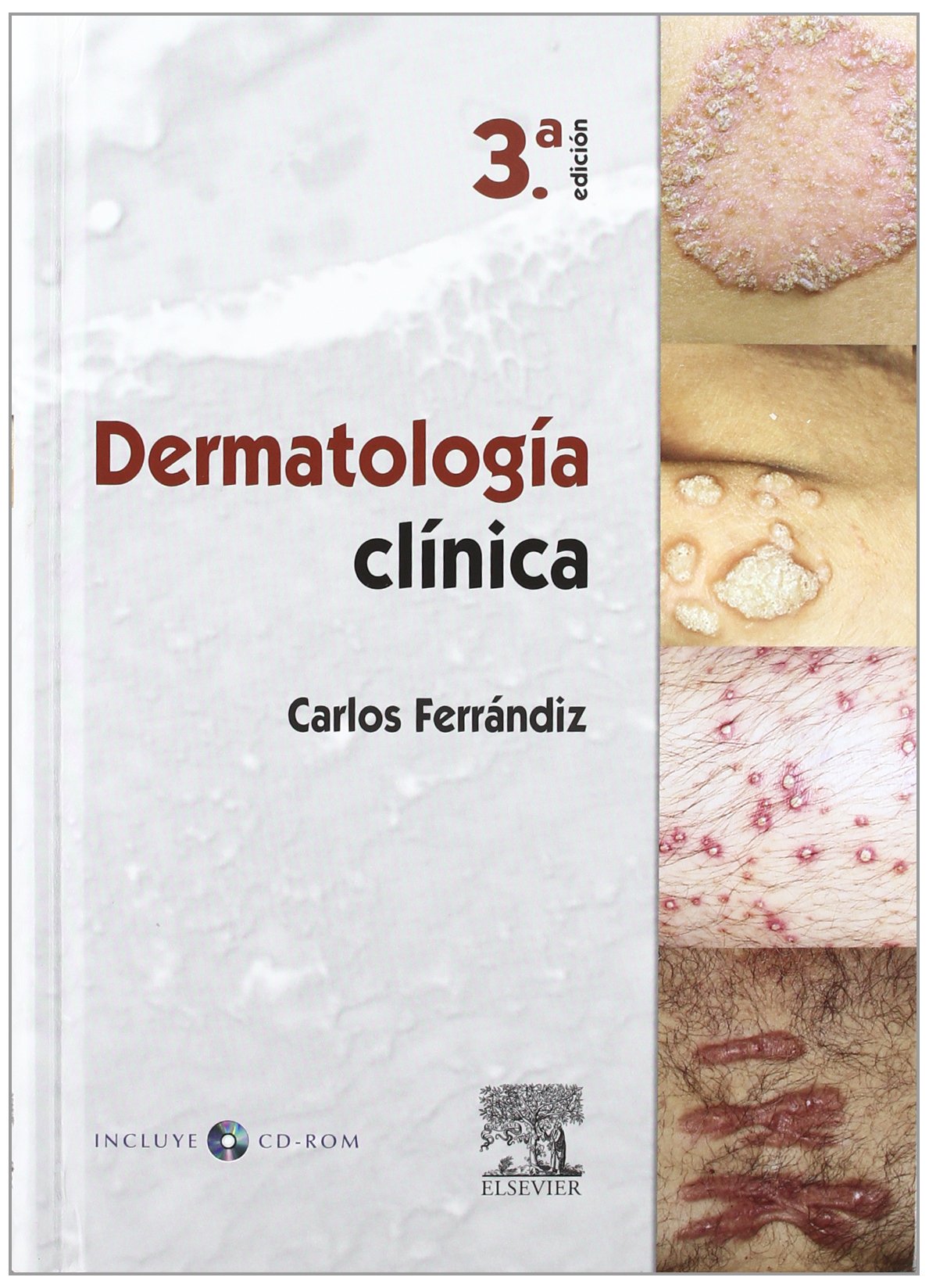 Dermatología clínica + CD-ROM