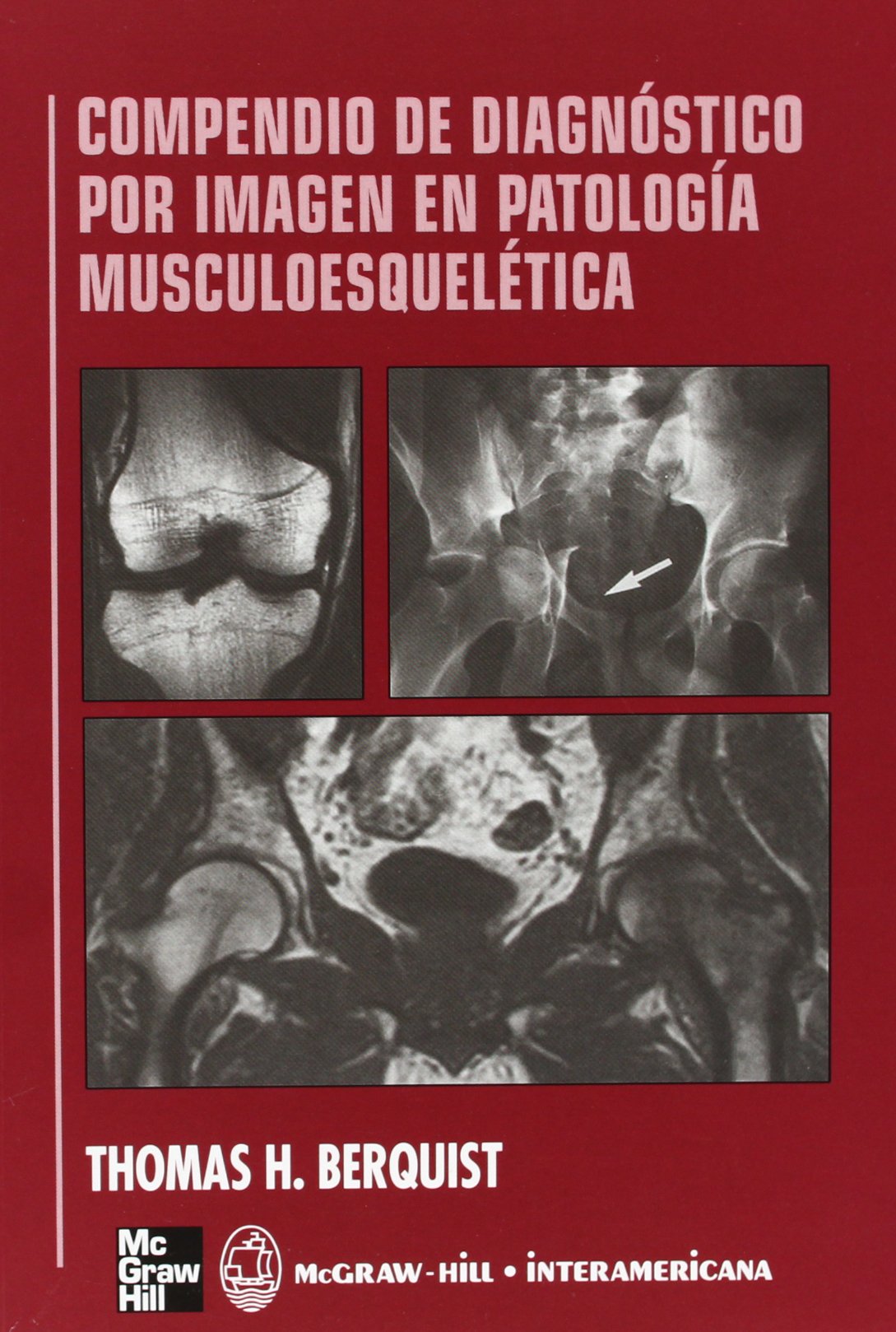 Compendio de diagnóstico por imagen en patología musculoesquelética (SIN COLECCION)