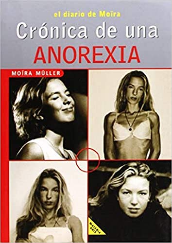 CRONICA DE UNA ANOREXIA