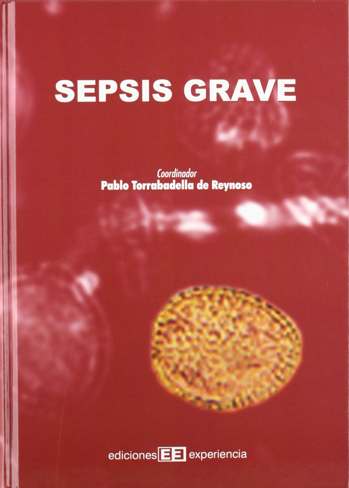 Sepsis grave