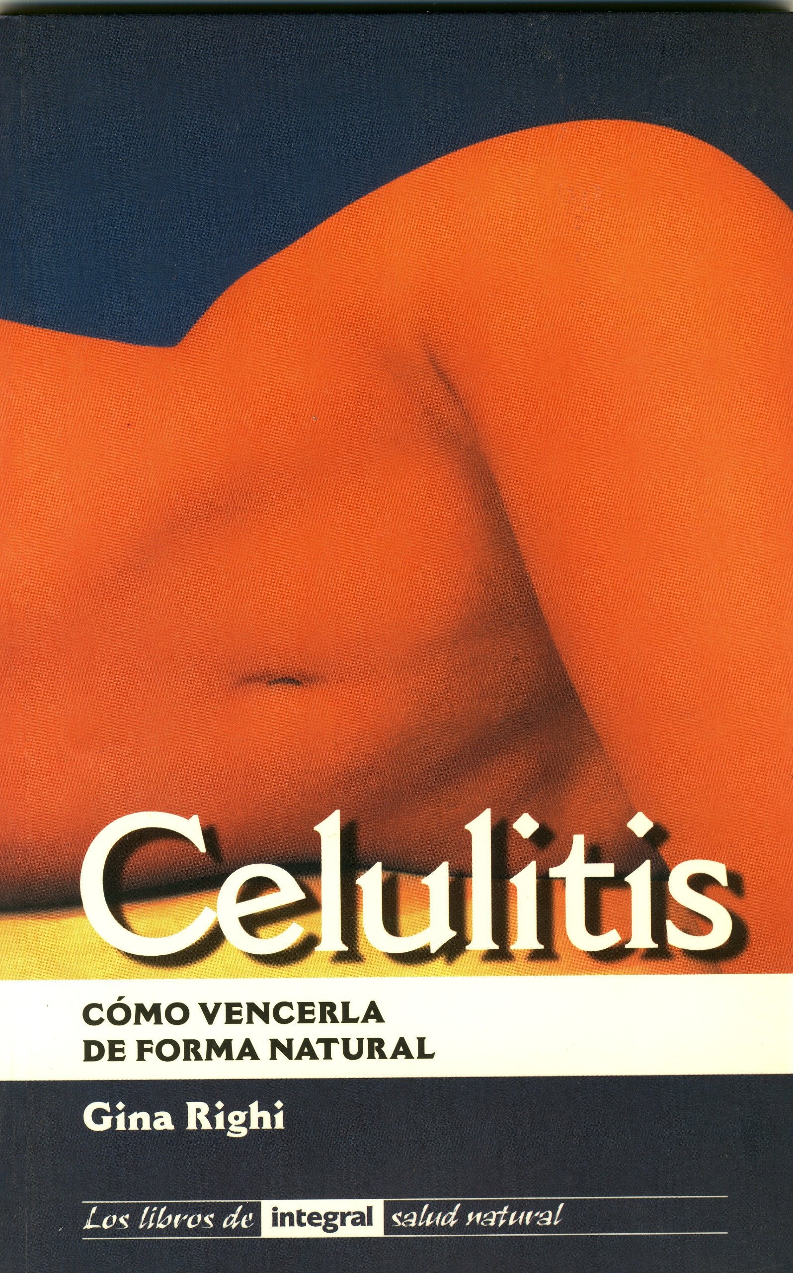 Celulitis