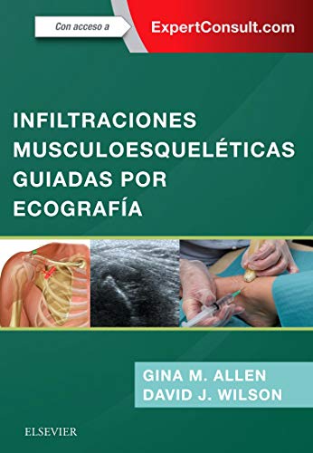 Infiltraciones musculoesqueléticas guiadas por ecografía