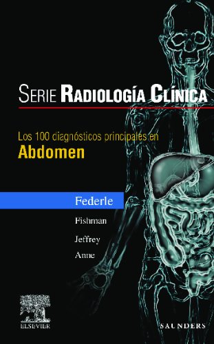 Serie Radiología Clínica: Los 100 diagnósticos principales en abdomen (Serie Pocket de Radiologia)