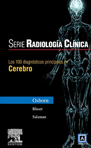 Serie Radiología Clínica: Los 100 diagnósticos principales en cerebro (Serie Pocket de Radiologia)