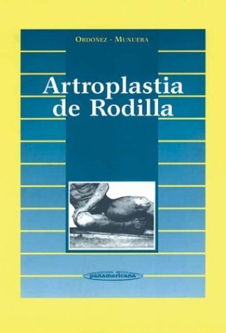 Artroplastia de Rodilla