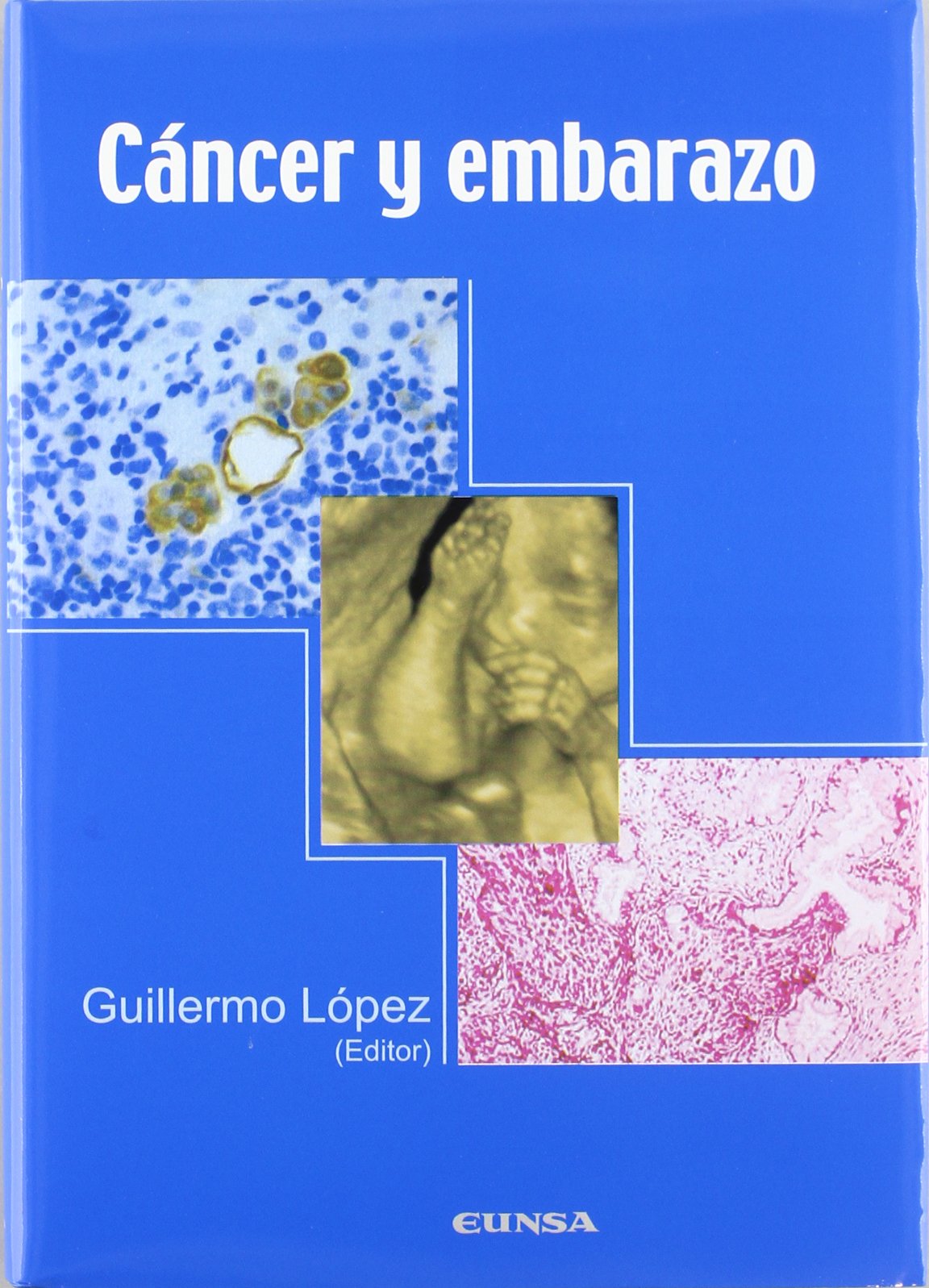 Cáncer y embarazo