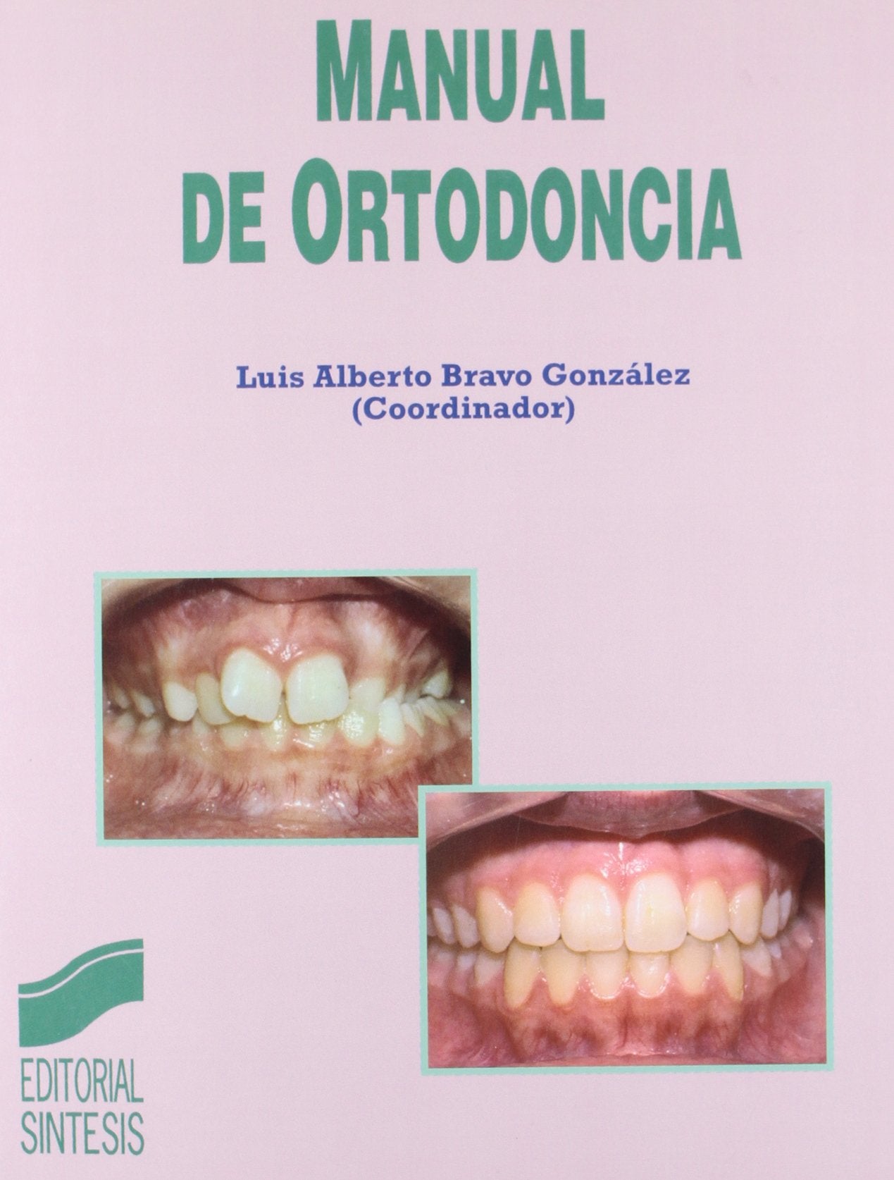 Manual de ortodoncia (SIN COLECCION)