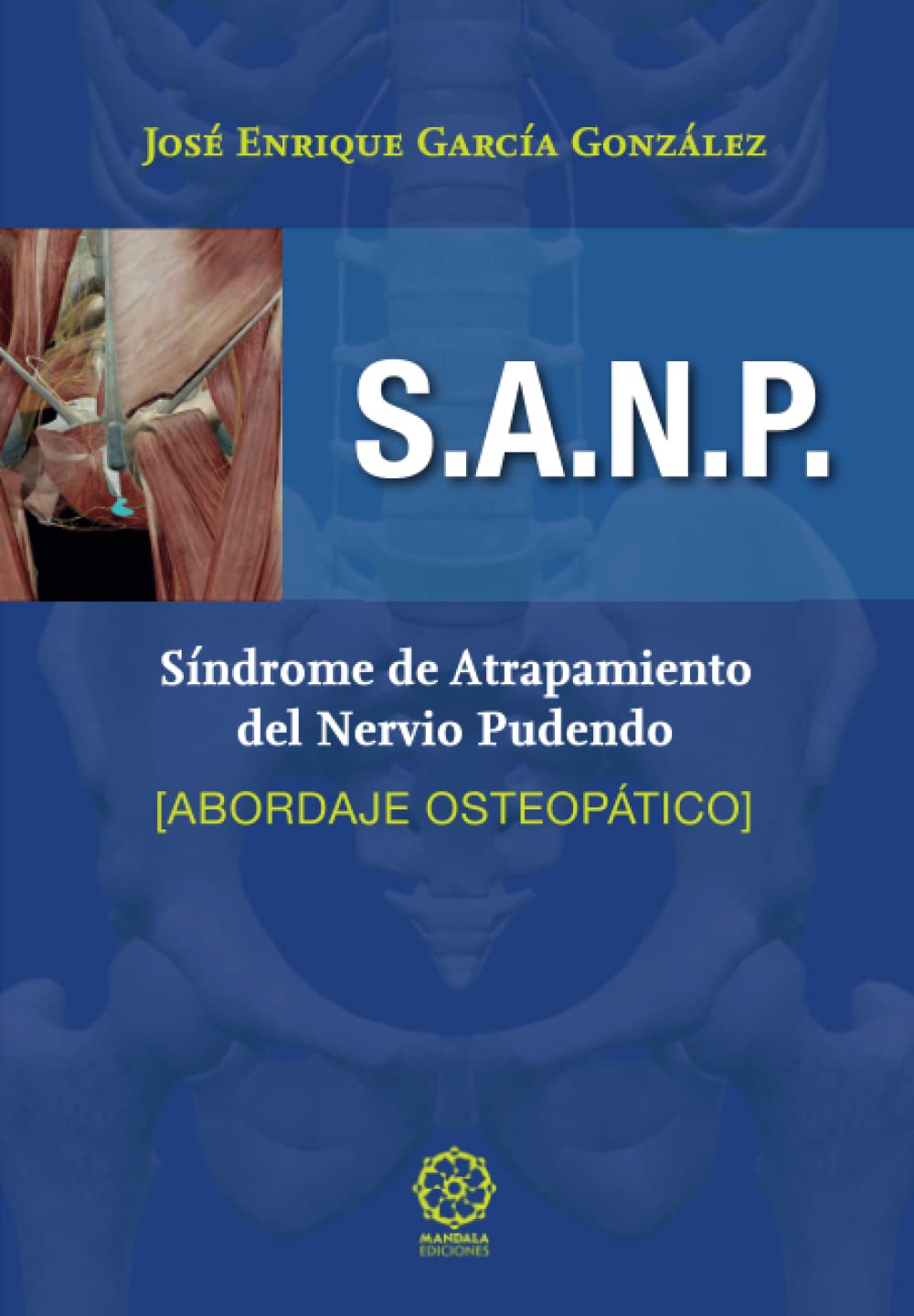 Síndrome de atrapamiento del nervio pudendo. Abordaje Osteopático