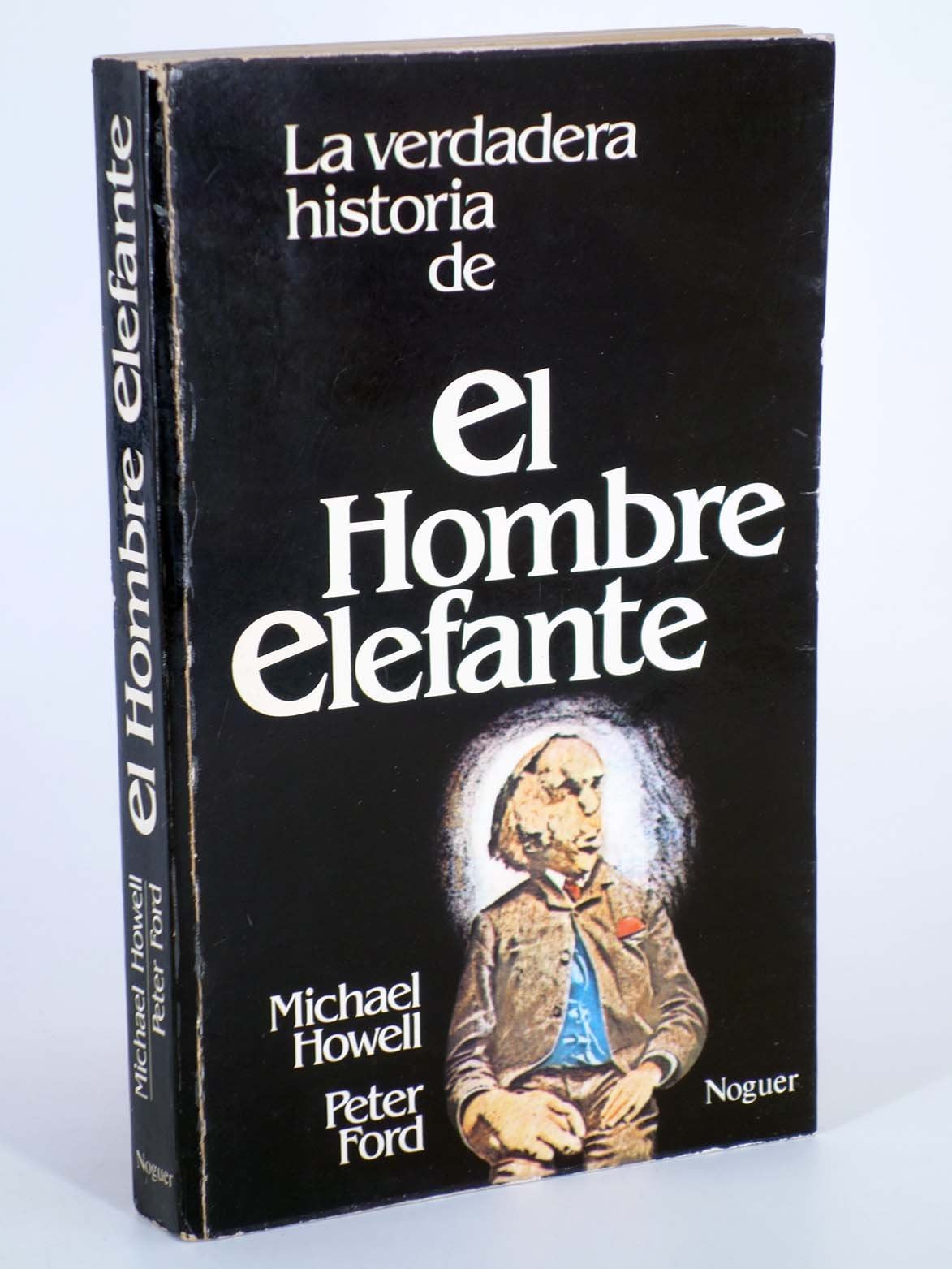 La verdadera historia del hombre elefante