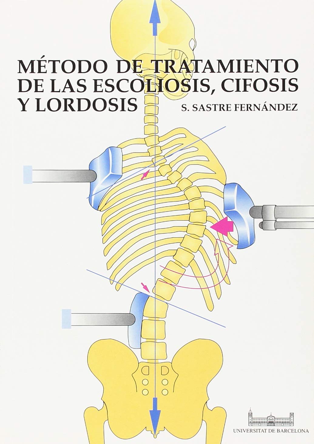 METODO DE TRATAMIENTO DE LAS ESCOLIOSIS, CIFOSIS Y LORDOSIS (SIN COLECCION)