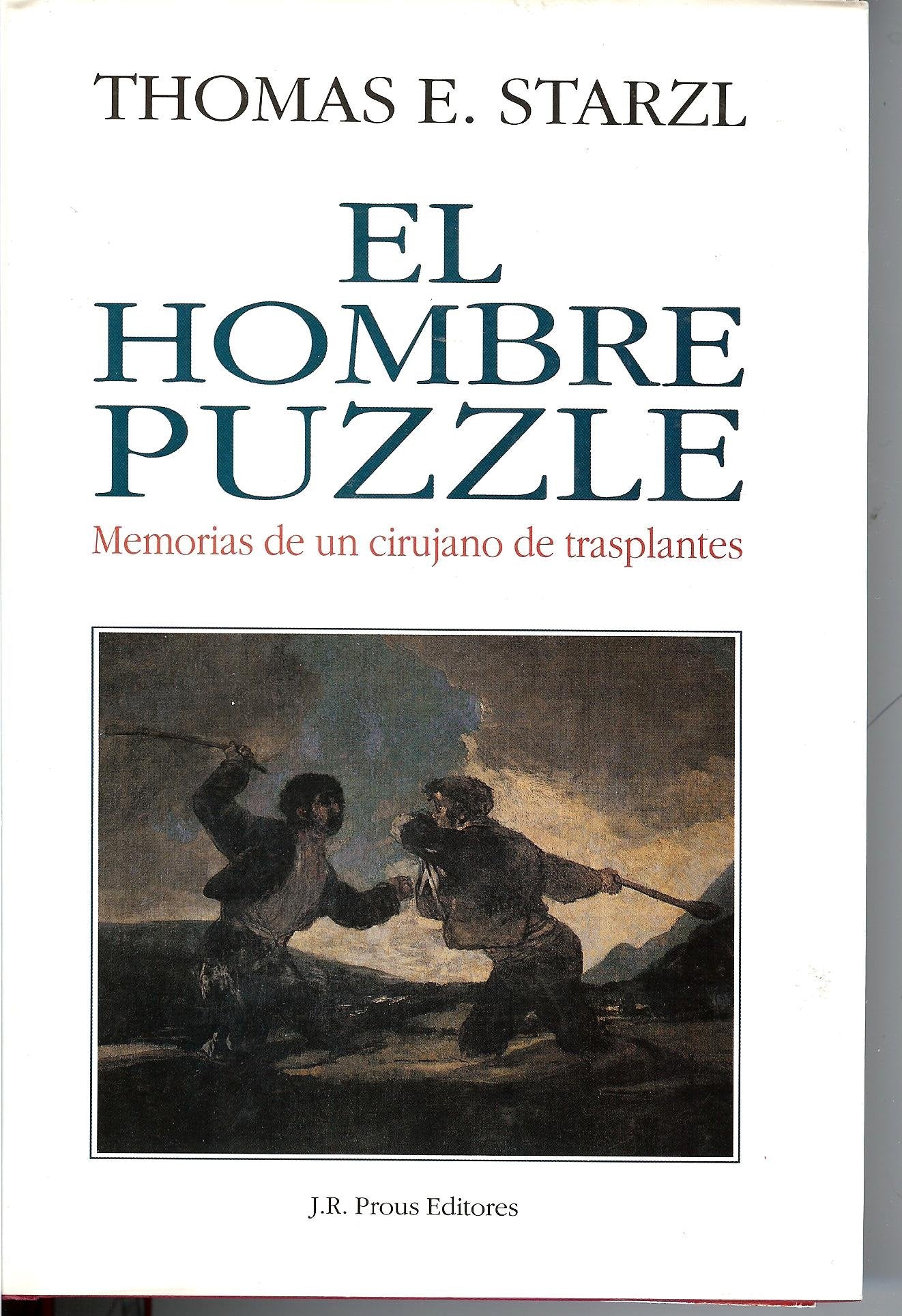 Hombre puzzle.memorias de cirujanode transplantes