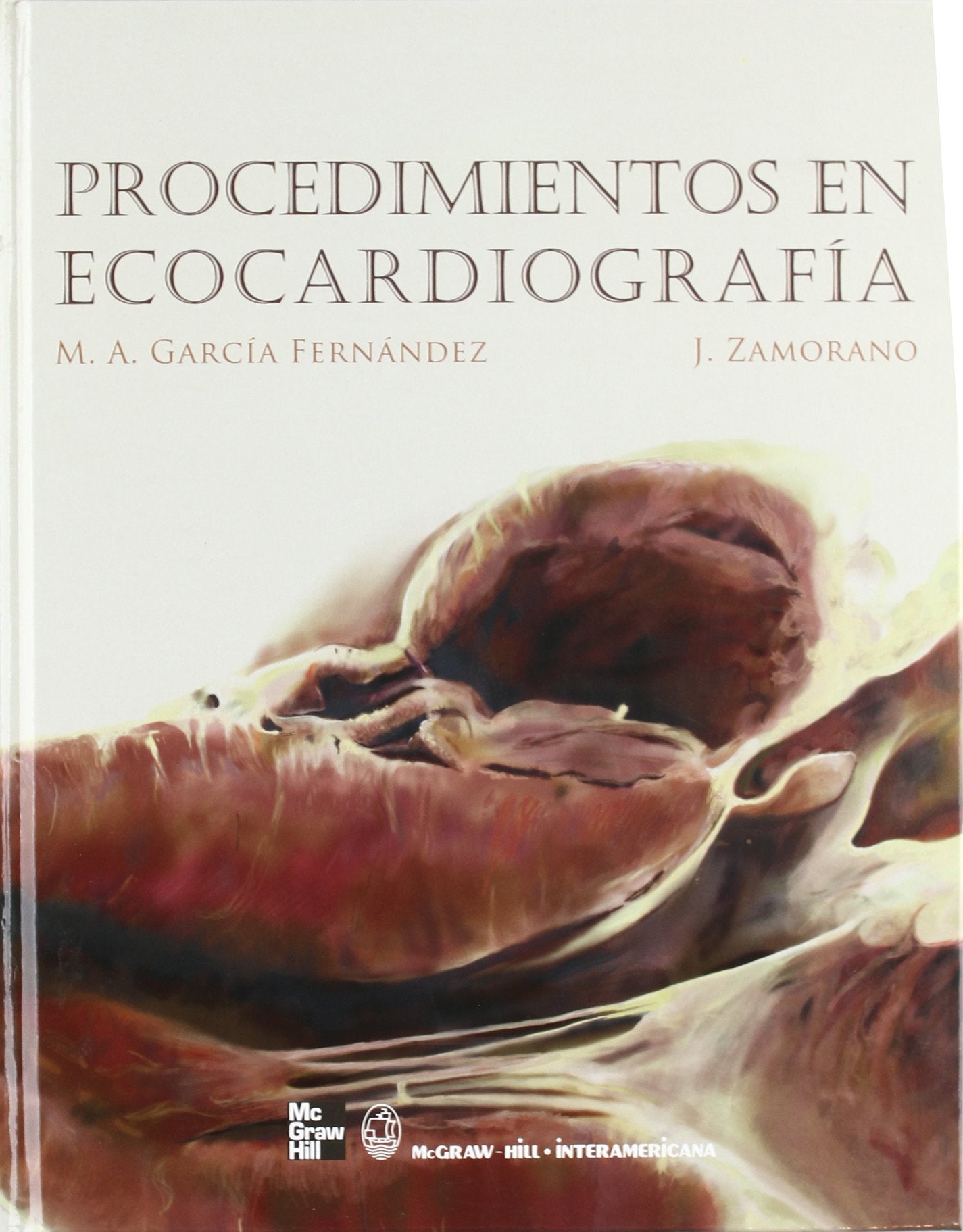 Procedimientos En Ecocardiografia (SIN COLECCION)